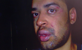 Ryan Achterkamp, nadat hij uit de cel kwam.